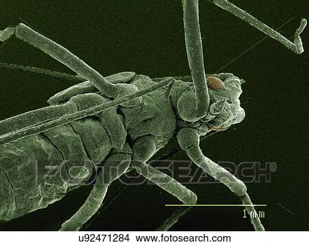 Picture - Coloured SEM of mouthparts of aphid. Fotosearch