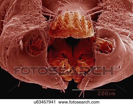 Stock Image - Coloured SEM of mouthparts of engorged female dog tick. Fotosearch