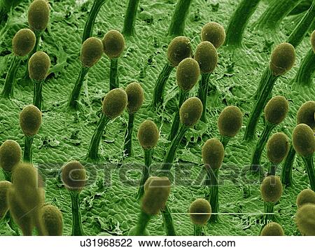 Stock Image - Coloured SEM of sticky hairs on sundew carnivorous plant. Fotosearch