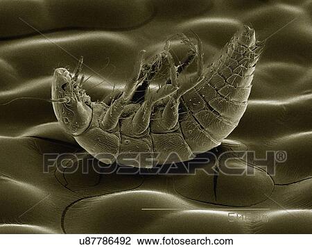 Coloured SEM of Triungulin larva of Meloid beetle (Meloidae) View Large Photo Image Stock Image - Coloured SEM of Triungulin larva of Meloid beetle (Meloidae). Fotosearch