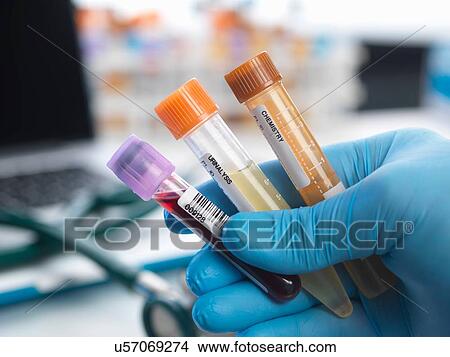 Picture - Human samples including blood, urine and chemistry being collected for testing. Fotosearch