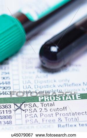 Stock Photo - Studio shot of blood sample tube (containing synthetic blood) on a haematology requisition form listing prostate-specific antigen (PSA) test.. Fotosearch