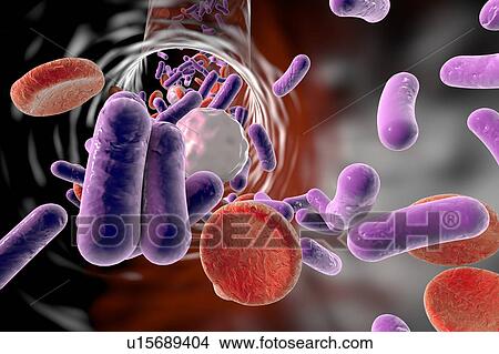 Bacteria in blood, illustration View Large Illustration Stock Illustration - Bacteria in blood, illustration. Fotosearch