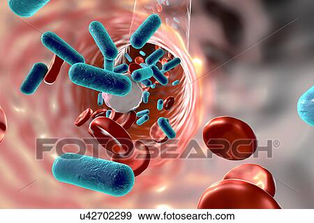 Stock Illustration - Bacteria in blood, illustration. Fotosearch