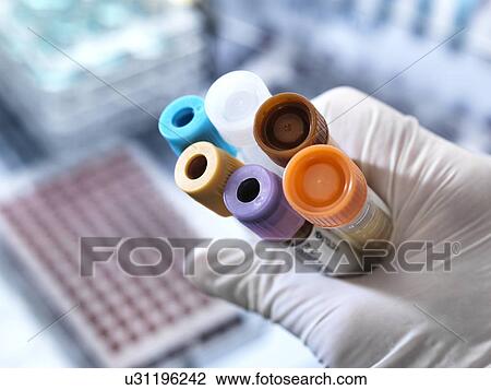Blood and other samples for testing View Large Photo Image Stock Image - Blood and other samples for testing. Fotosearch