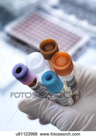 Blood and other samples for testing View Large Photo Image Stock Photo - Blood and other samples for testing. Fotosearch