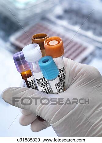 Stock Photo - Blood and other samples for testing. Fotosearch