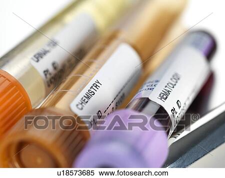 Stock Photography - Blood and other samples for testing. Fotosearch