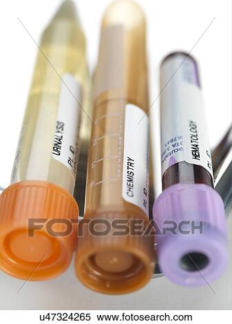 Stock Photography - Blood and other samples for testing. Fotosearch
