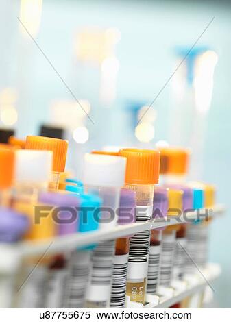 Blood sample for medical testing in laboratory View Large Photo Image Stock Photography - Blood sample for medical testing in laboratory. Fotosearch