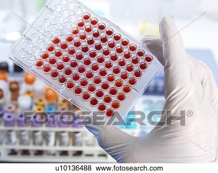 Blood screening View Large Photo Image Stock Photo - Blood screening. Fotosearch