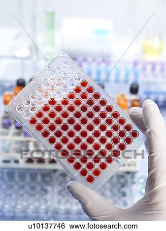 Stock Photograph - Blood screening. Fotosearch