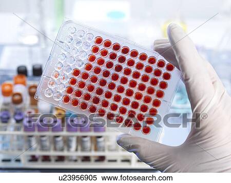 Stock Photography - Blood screening. Fotosearch