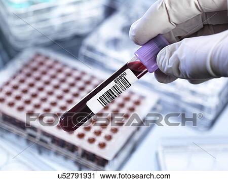Blood testing View Large Photo Image Stock Image - Blood testing. Fotosearch
