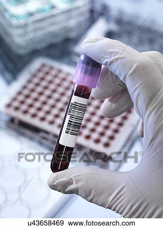 Stock Photo - Blood testing. Fotosearch