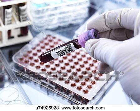 Blood testing View Large Photo Image Stock Photo - Blood testing. Fotosearch