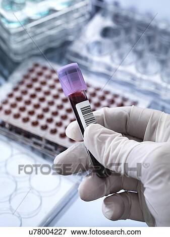 Stock Photo - Blood testing. Fotosearch