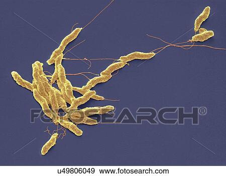 Campylobacter jejuni bacteria, SEM View Large Illustration Stock Illustration - Campylobacter jejuni bacteria, SEM. Fotosearch