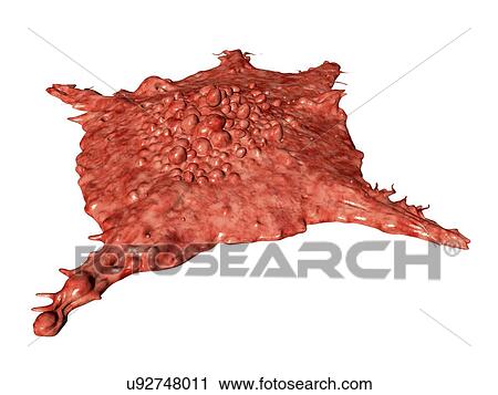 Stock Image - "Cancer cell, illustration". Fotosearch