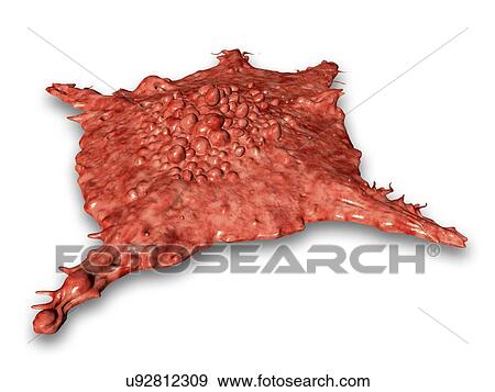 "Cancer cell, illustration" View Large Photo Image Stock Photo - "Cancer cell, illustration". Fotosearch