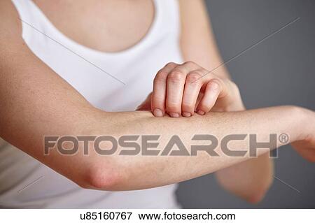 Stock Photo - Cropped shot of young woman scratching her forearm with fingers. Fotosearch