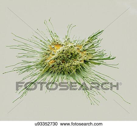 Stock Image - "Dendritic cell, SEM". Fotosearch