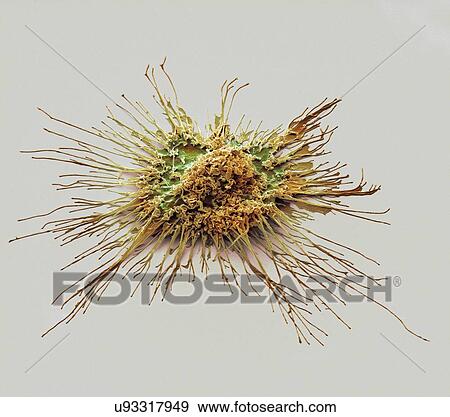 Stock Photo - "Dendritic cell, SEM". Fotosearch