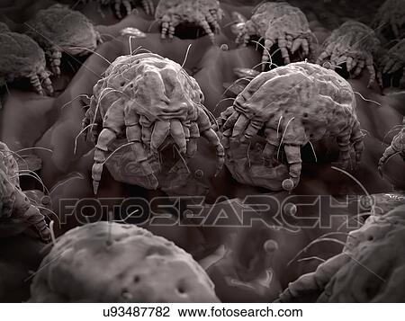 "Dust mites, illustration" View Large Photo Image Stock Image - "Dust mites, illustration". Fotosearch