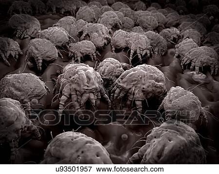 Stock Photo - "Dust mites, illustration". Fotosearch