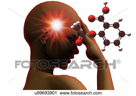 Headache, illustration View Large Illustration Clip Art - Headache, illustration. Fotosearch