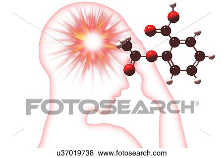 Headache, illustration View Large Illustration Stock Illustration - Headache, illustration. Fotosearch