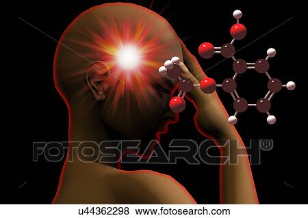 Headache, illustration View Large Illustration Stock Illustration - Headache, illustration. Fotosearch