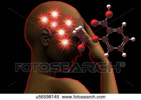 Stock Illustration - Headache, illustration. Fotosearch