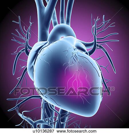 Heart attack, conceptual artwork View Large Illustration Stock Illustration - Heart attack, conceptual artwork. Fotosearch