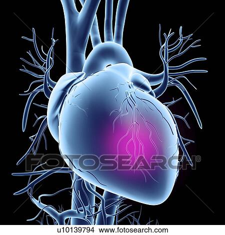 Heart attack, conceptual artwork View Large Illustration Stock Illustration - Heart attack, conceptual artwork. Fotosearch