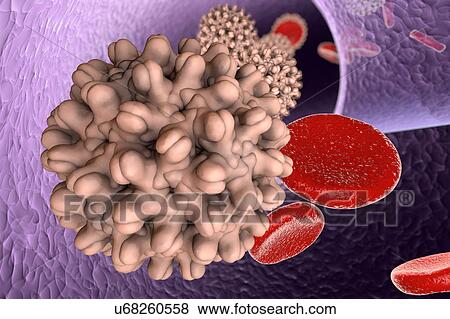 Stock Illustration - Hepatitis B virus in blood, illustration. Fotosearch
