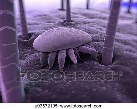 "Honeybee mite, artwork" View Large Photo Image Stock Photography - "Honeybee mite, artwork". Fotosearch