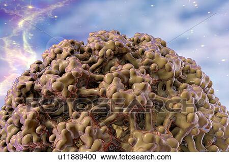 Clipart - Human papilloma virus, illustration. Fotosearch