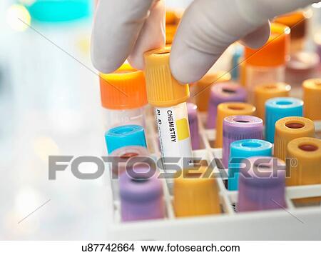Picture - Laboratory technican preparing human chemistry sample for medical testing in laboratory. Fotosearch
