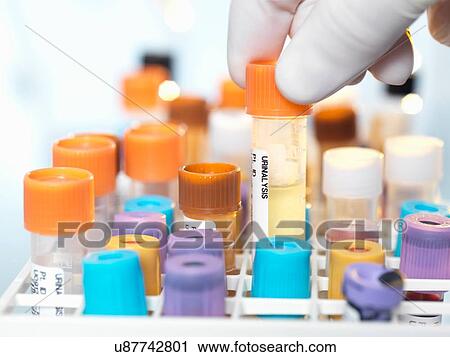 Laboratory technican preparing urine sample for medical testing in laboratory View Large Photo Image Stock Image - Laboratory technican preparing urine sample for medical testing in laboratory. Fotosearch
