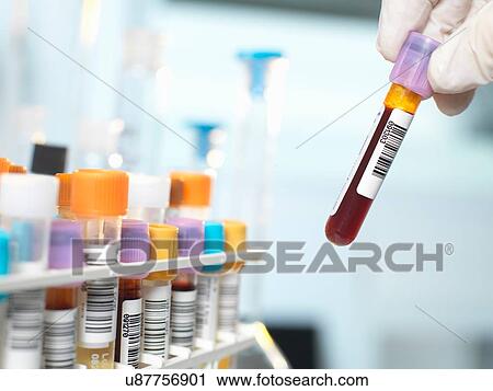 Stock Image - Laboratory technician preparing blood sample for medical testing in laboratory. Fotosearch
