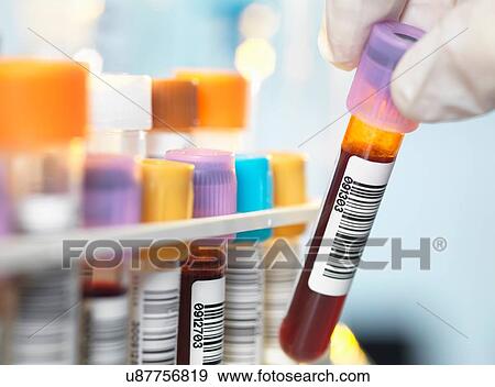 Laboratory technician preparing blood sample for medical testing in laboratory View Large Photo Image Stock Photo - Laboratory technician preparing blood sample for medical testing in laboratory. Fotosearch