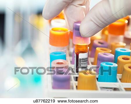 Laboratory technician preparing blood sample for medical testing in laboratory View Large Photo Image Stock Photo - Laboratory technician preparing blood sample for medical testing in laboratory. Fotosearch