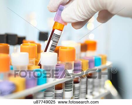 Laboratory technician preparing blood sample for medical testing in laboratory View Large Photo Image Stock Photography - Laboratory technician preparing blood sample for medical testing in laboratory. Fotosearch