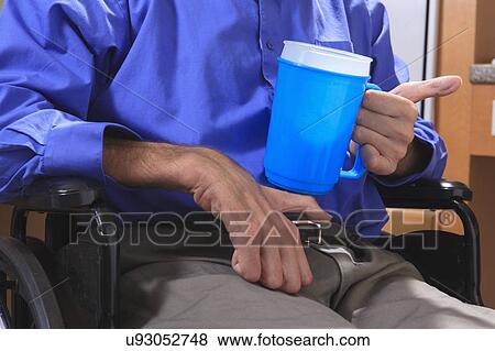 Man with deformed hands in the kitchen View Large Photo Image Stock Photo - Man with deformed hands in the kitchen. Fotosearch