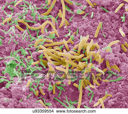 "Tongue bacteria, SEM" View Large Photo Image Picture - "Tongue bacteria, SEM". Fotosearch