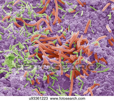 Stock Image - "Tongue bacteria, SEM". Fotosearch