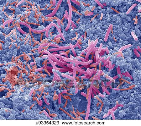 "Tongue bacteria, SEM" View Large Photo Image Stock Photo - "Tongue bacteria, SEM". Fotosearch