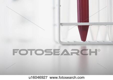 Stock Photo - Blood sample in test tube. Fotosearch