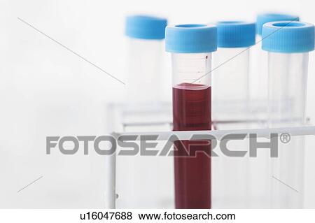 Stock Photo - Blood sample in test tube. Fotosearch